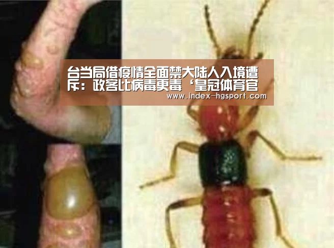 台当局借疫情全面禁大陆人入境遭斥:政客比病毒更毒‘皇冠体育官网’(图1) 皇冠体育网址